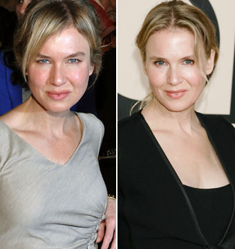 What the Face? Renée Zellweger Is Nearly Unrecognizable