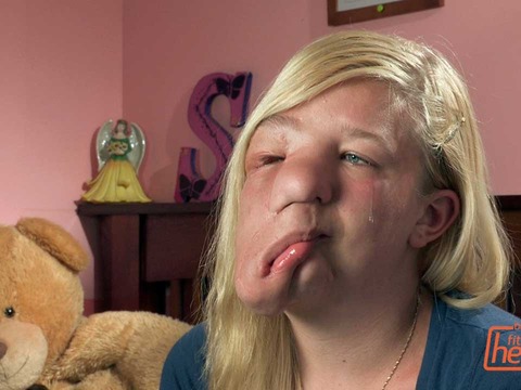 Sneak Peek! A Heart-Wrenching Look at 'The Girl with Half a Face'